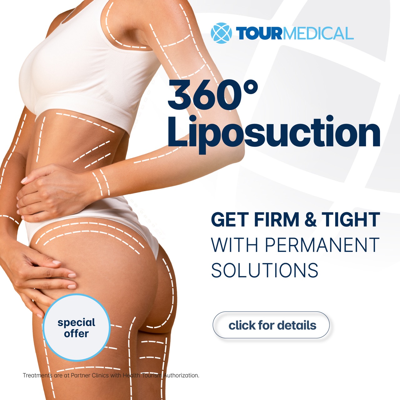 360 Liposuctie Aanbieding img