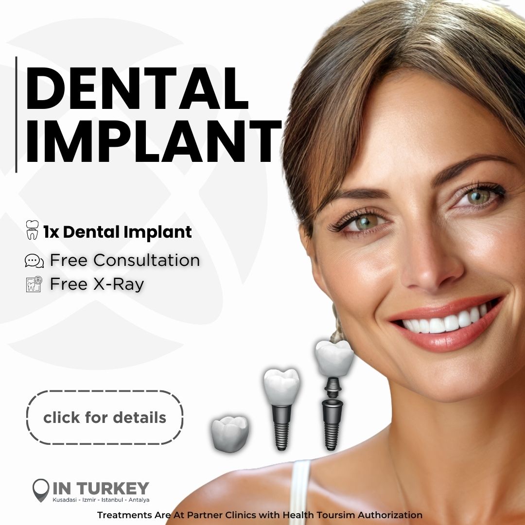 Dental Implant Offer